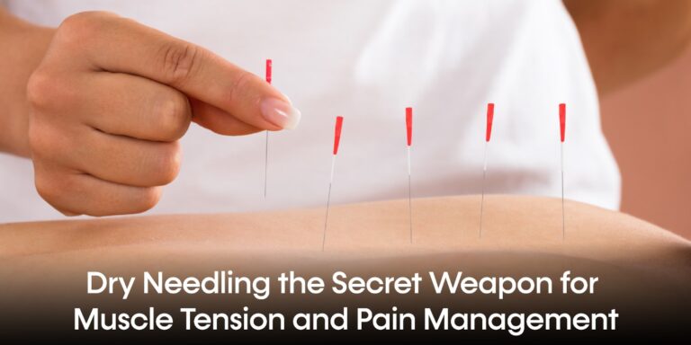 dry needling in Islamabad